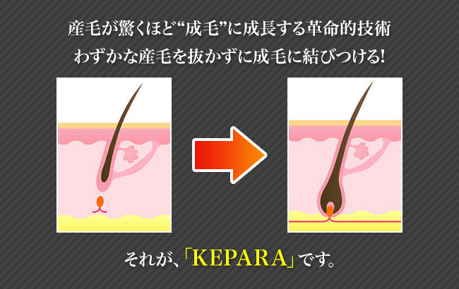 産毛が驚くほど“成毛”に成長する革命的技術わずかな産毛を抜かずに成毛に結びつける!それが、「KEPARA」です。